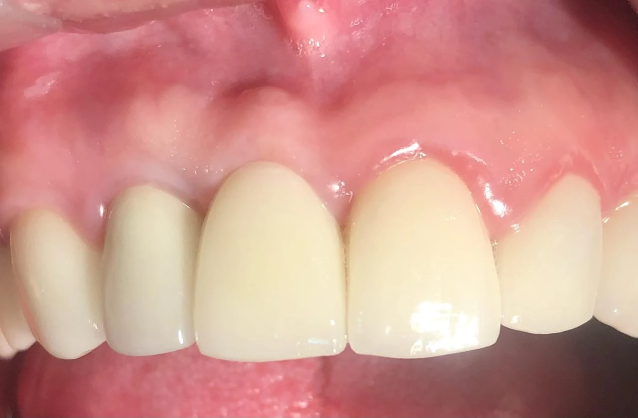 Fotografía clínica dental