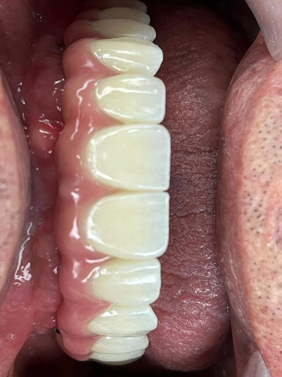 Fotografía clínica dental