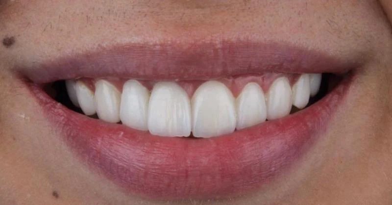 Fotografía clínica dental
