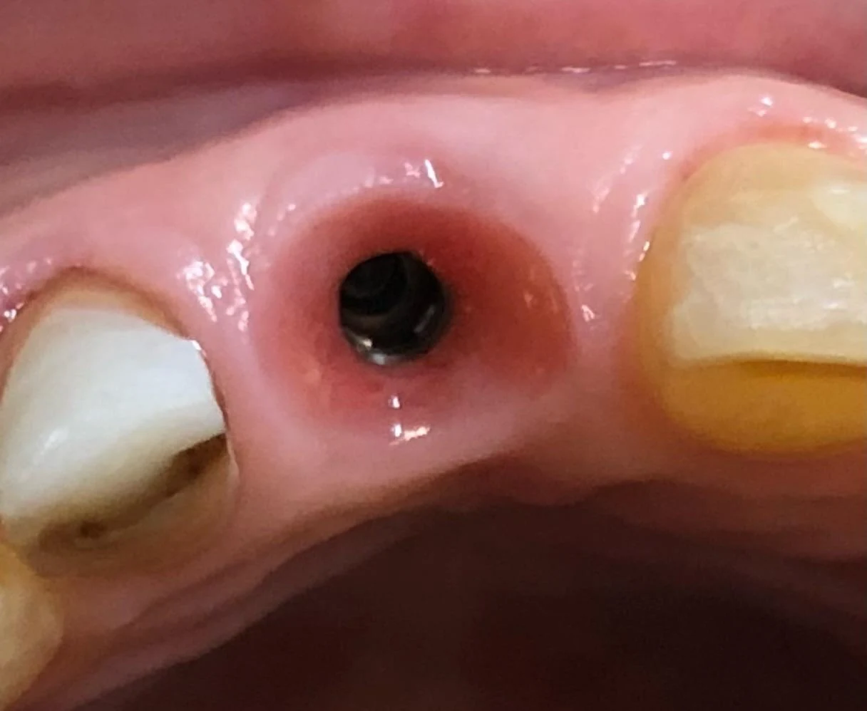 Fotografía clínica dental