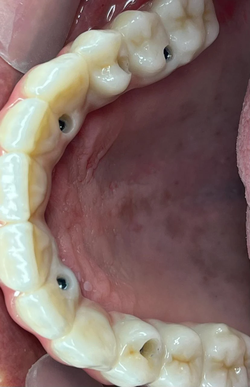 Fotografía clínica dental