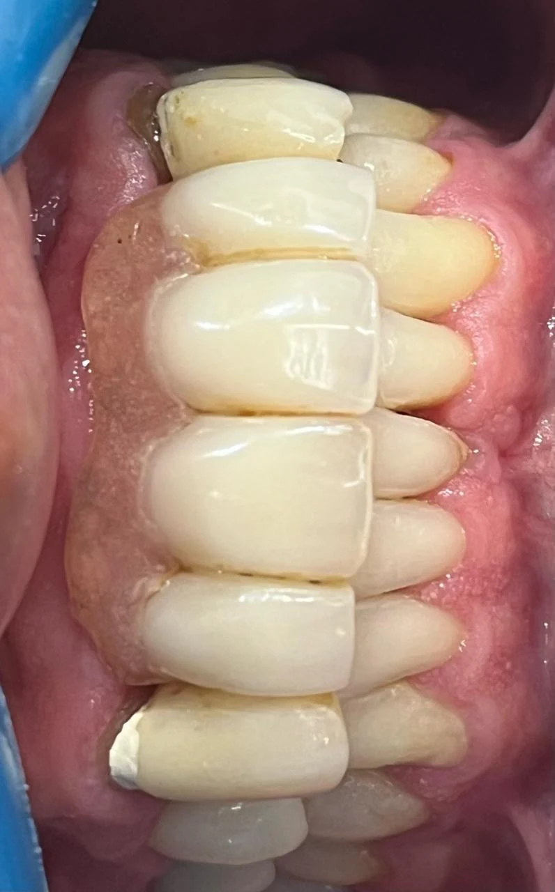 Fotografía clínica dental
