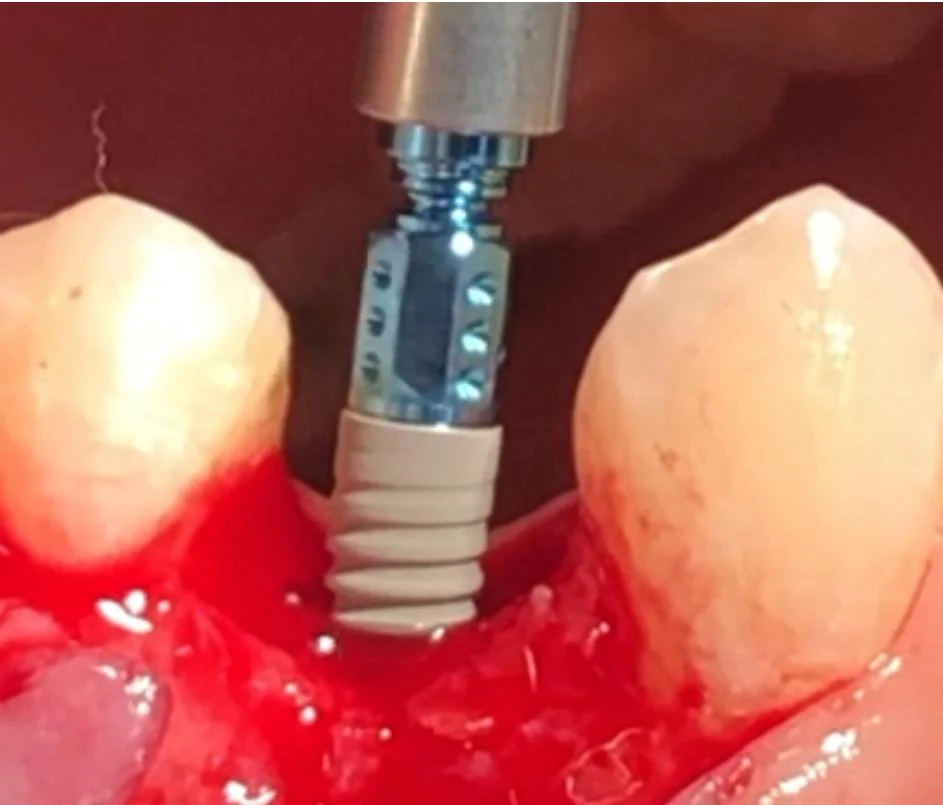 Fotografía clínica dental