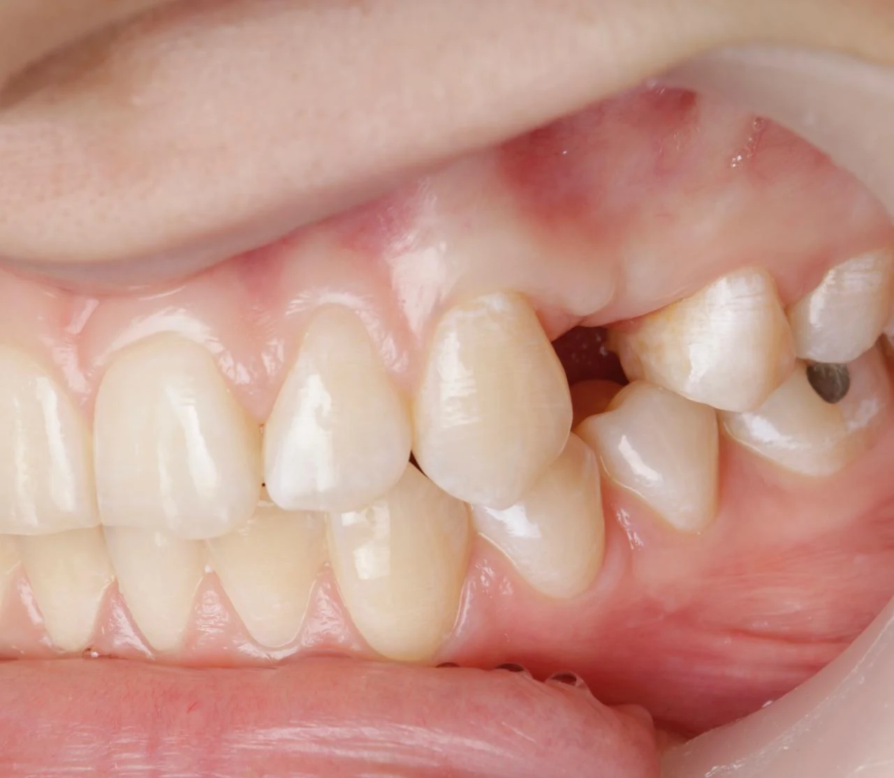 Fotografía clínica dental